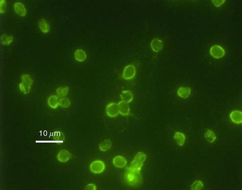  Cryptosporidium: Mistrz kamuflażu i król niechcianych niespodzianek!